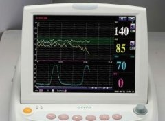 医疗监护仪应用        